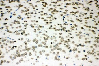Sumo 1/SUMO1 Rabbit Polyclonal Antibody