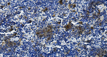Tigit Rabbit Polyclonal Antibody