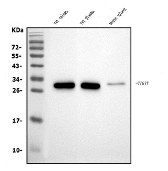 Tigit Rabbit Polyclonal Antibody