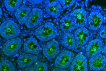 Tspan1 Rabbit Polyclonal Antibody