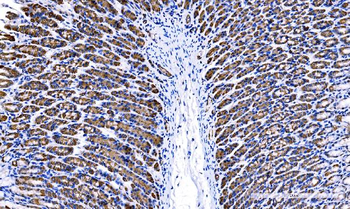 Tspan1 Rabbit Polyclonal Antibody