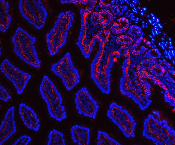 Tspan-8/Tspan8 Rabbit Polyclonal Antibody