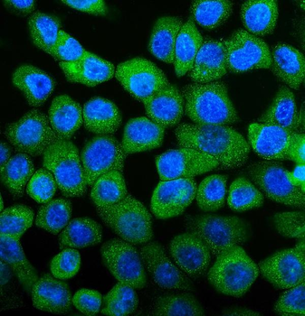 UBE2D1/2/3/4 Rabbit Polyclonal Antibody