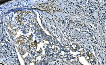 UBE2D1/2/3/4 Rabbit Polyclonal Antibody
