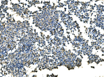 UBE2D1/2/3/4 Rabbit Polyclonal Antibody