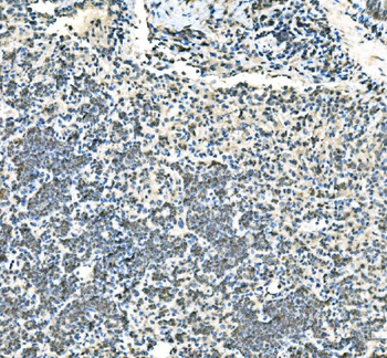 UBE2D1/2/3/4 Rabbit Polyclonal Antibody