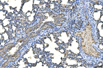 UBE2D1/2/3/4 Rabbit Polyclonal Antibody