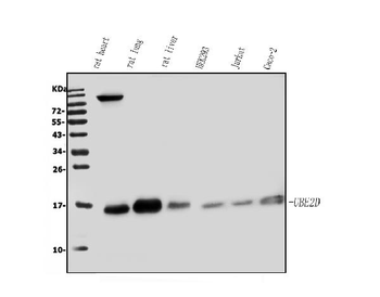 UBE2D1/2/3/4 Rabbit Polyclonal Antibody
