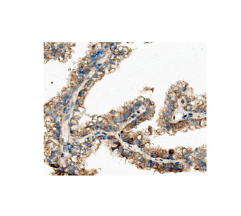 ch TOG/CKAP5 Mouse Monoclonal Antibody
