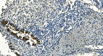 IDH2 Mouse Monoclonal Antibody