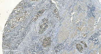 IDH2 Mouse Monoclonal Antibody