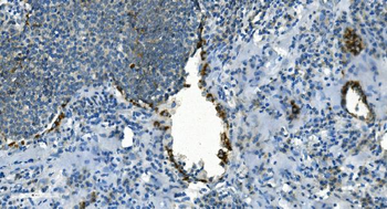 IDH2 Mouse Monoclonal Antibody