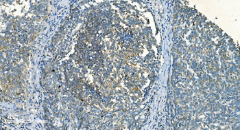 IDH2 Mouse Monoclonal Antibody