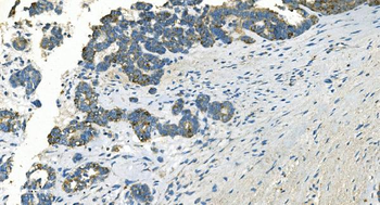 IDH2 Mouse Monoclonal Antibody
