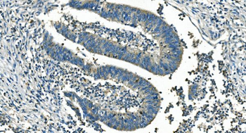 IDH2 Mouse Monoclonal Antibody