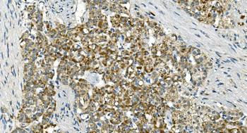 IDH2 Mouse Monoclonal Antibody