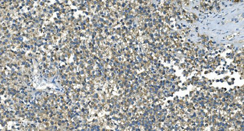 IDH2 Mouse Monoclonal Antibody
