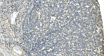 IDH2 Mouse Monoclonal Antibody