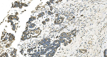 IDH2 Mouse Monoclonal Antibody