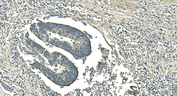 IDH2 Mouse Monoclonal Antibody