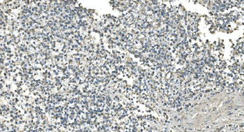 IDH2 Mouse Monoclonal Antibody
