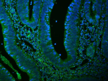 Filamin A/FLNA Mouse Monoclonal Antibody