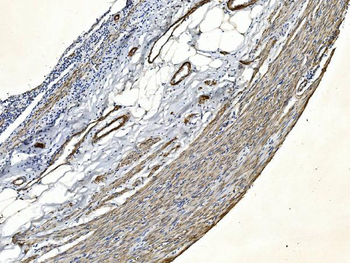 Filamin A/FLNA Mouse Monoclonal Antibody
