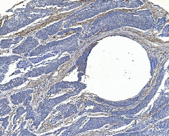 Filamin A/FLNA Mouse Monoclonal Antibody