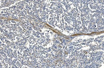 Filamin A/FLNA Mouse Monoclonal Antibody