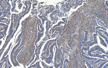 Filamin A/FLNA Mouse Monoclonal Antibody