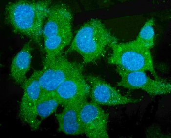 Liver Carboxylesterase 1/CES1 Mouse Monoclonal Antibody