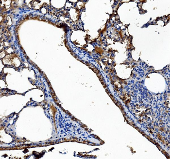 Liver Carboxylesterase 1/CES1 Mouse Monoclonal Antibody