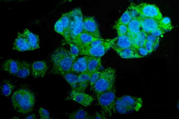 PCK2 Mouse Monoclonal Antibody
