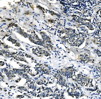 PCK2 Mouse Monoclonal Antibody