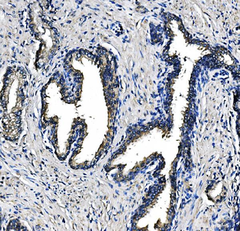 PCK2 Mouse Monoclonal Antibody