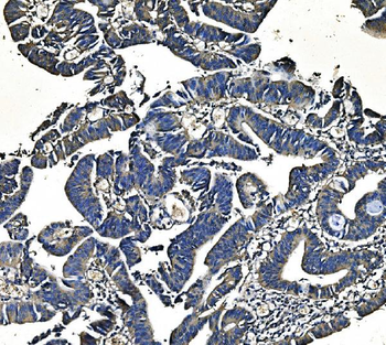 PCK2 Mouse Monoclonal Antibody