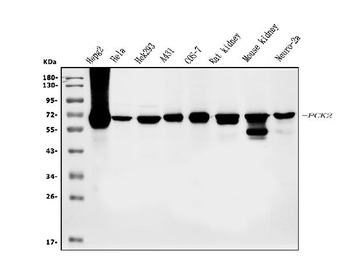 PCK2 Mouse Monoclonal Antibody