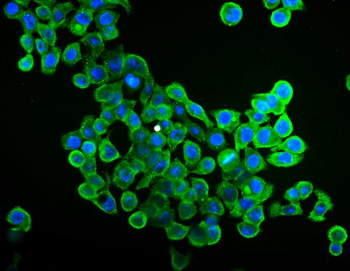 EIF4A1 Mouse Monoclonal Antibody