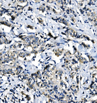 EIF4A1 Mouse Monoclonal Antibody