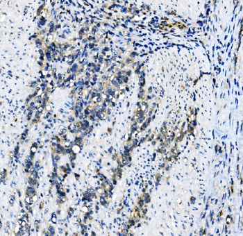 EIF4A1 Mouse Monoclonal Antibody
