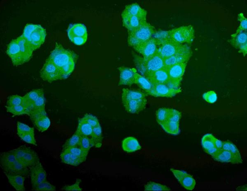 Aldolase/ALDOA Mouse Monoclonal Antibody