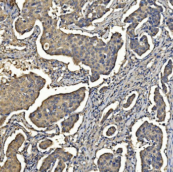 Aldolase/ALDOA Mouse Monoclonal Antibody