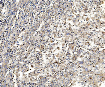 Aldolase/ALDOA Mouse Monoclonal Antibody