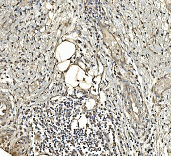 Aldolase/ALDOA Mouse Monoclonal Antibody