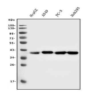 Aldolase/ALDOA Mouse Monoclonal Antibody