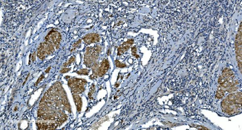 Actin/ACTA1 Mouse Monoclonal Antibody