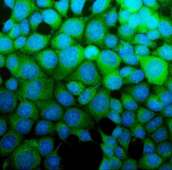 ASS1 Mouse Monoclonal Antibody