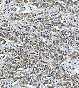 ASS1 Mouse Monoclonal Antibody