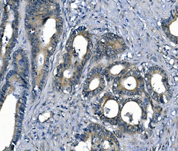 ASS1 Mouse Monoclonal Antibody
