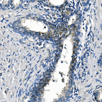ASS1 Mouse Monoclonal Antibody